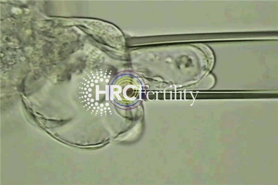 细胞提取-囊胚