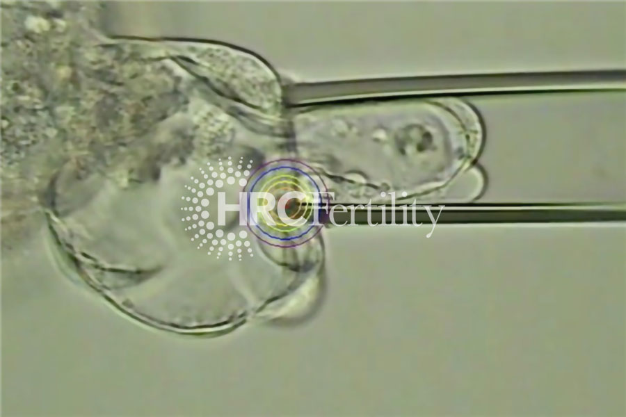 囊胚细胞提取