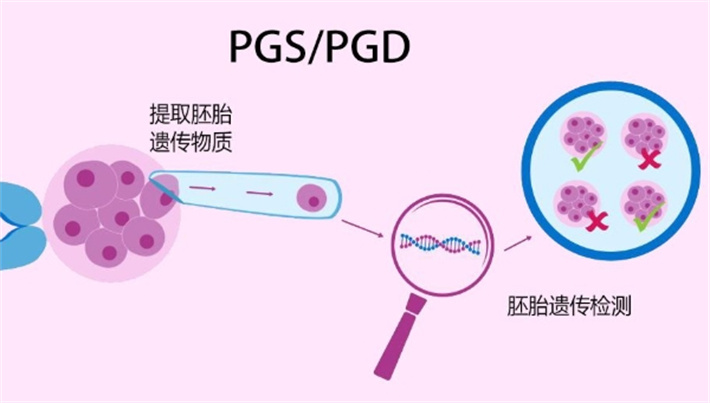 pgs,pgd