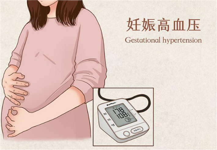 妊娠高血压和糖尿病