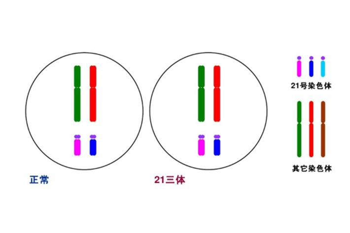 染色体异常