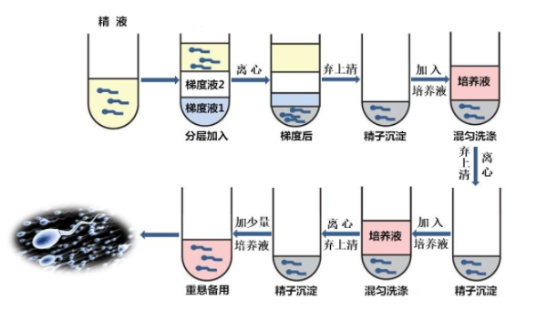 梯度离心精子洗涤技术.png