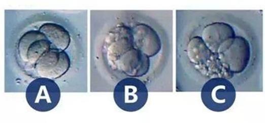 胚胎等级
