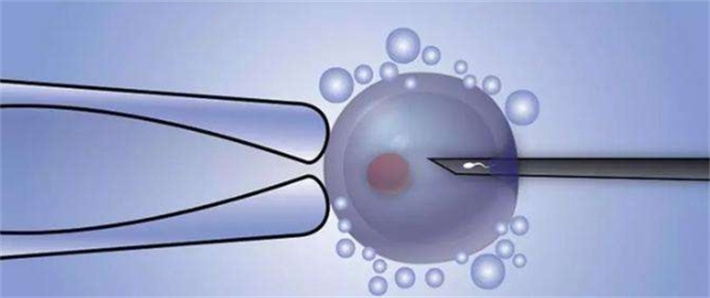单精子注射技术