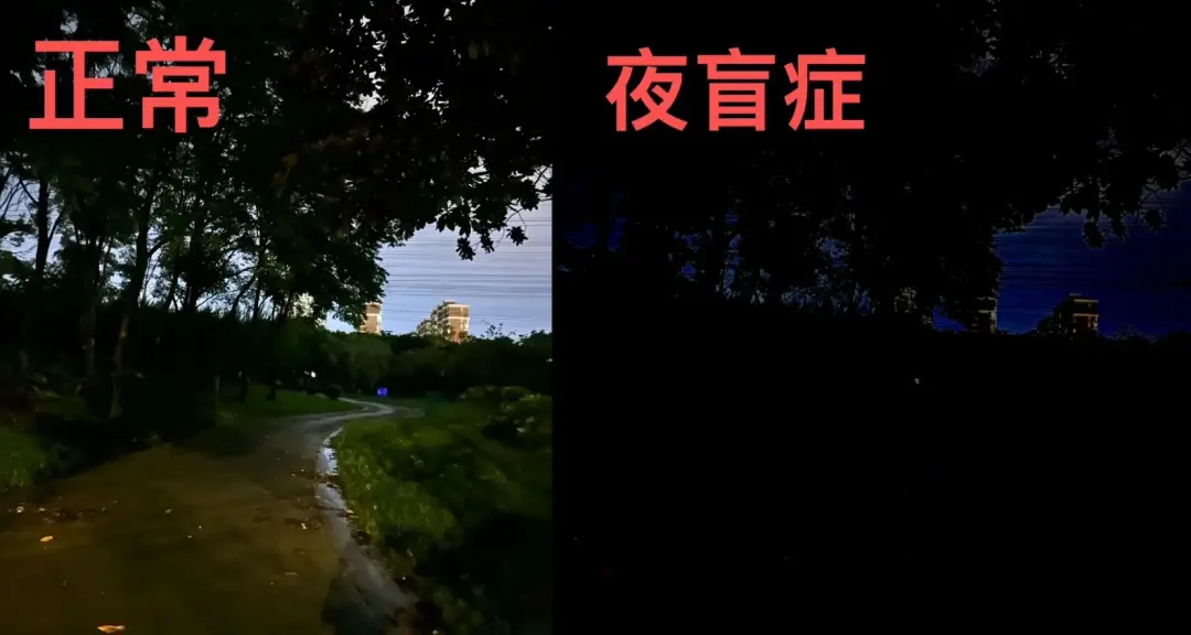 夜盲症